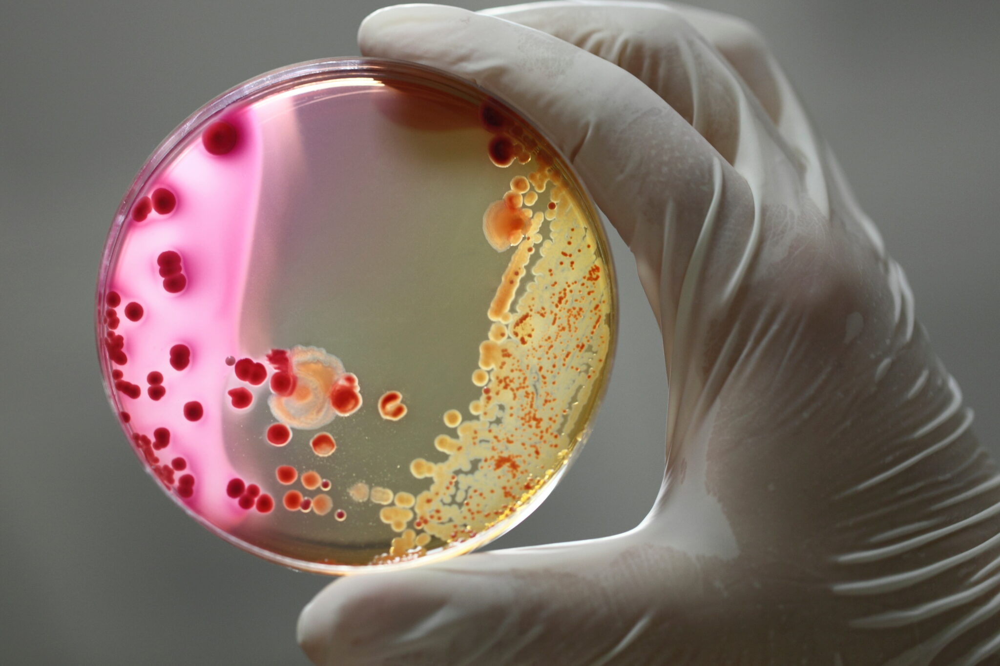 bacteria