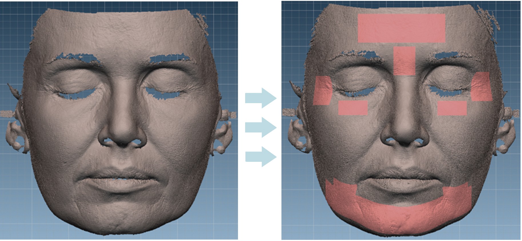 Zonas de evaluación escaneo 3D de alta resolución copia