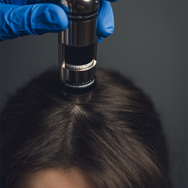 Trichoscope